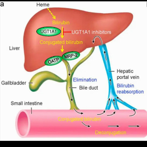 Allele frequency of genetic variations related to the UGT1A1 gene- drug pair in a group of Iranian population